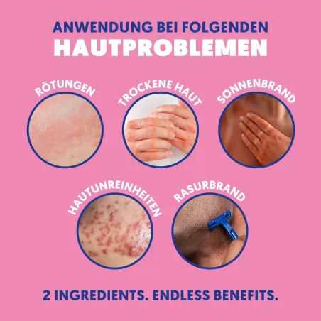 HOCl Spray refreshing spray with hypochlorous acid | A.N.D. beauty