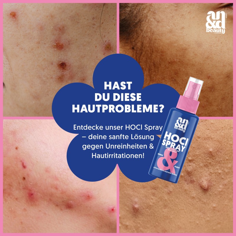 HOCl Spray 100 ml